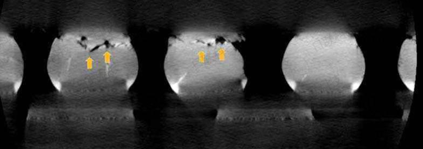 日联科技BGA检测